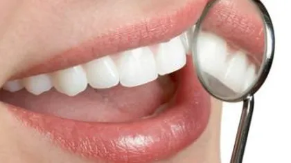 Detartrajul regulat al dinţilor reduce riscul cardiovascular
