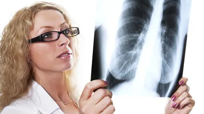 Radiografii pulmonare gratuite, între 4 şi 30 noiembrie