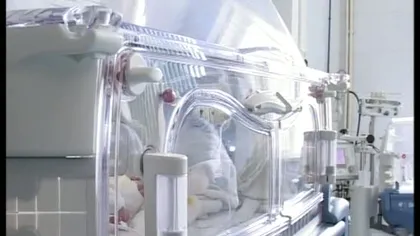 Fetiţele siameze născute la Piteşti, în stare gravă la Spitalul Grigore Alexandrescu din Capitală