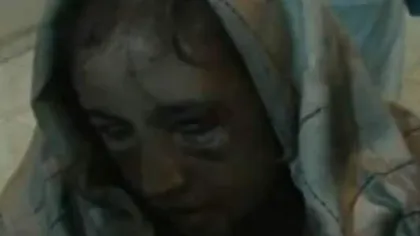 O tânără din Afganistan, torturată de familie ca în vremea Inchiziţiei