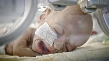 Bebeluşul român născut fără intestine, operat de medicii americani
