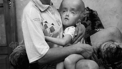 Greenpeace: Expoziţie fotografică cu victimele de la Cernobîl, la Muzeul Bucureştiului FOTO