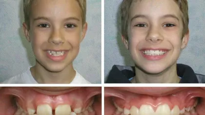 Majoritatea pacienților unui medic ortodont sunt copii până în 16 ani