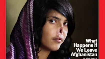 Femeia mutilată de soţ, la 4 ani după fuga din ţară. Povestea care a impresionat o lume întreagă