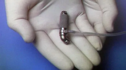 Cea mai mică inimă artificială, implantată unui bebeluş în vârstă de 16 luni FOTO