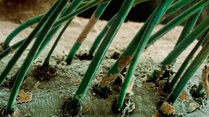 Cum arată firul de păr la microscop. 15 imagini uluitoare ale corpului uman GALERIE FOTO
