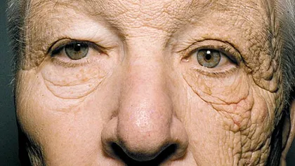 Fotografia şocantă care îţi arată cât de mult te îmbătrâneşte Soarele