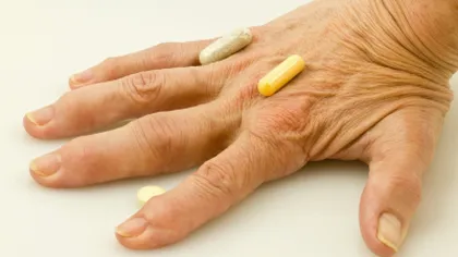 Mituri despre artrită, demolate