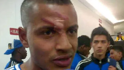 I-a dat un cot în faţă şi un şut în cap. Agresiunea şocantă a unui fotbalist, în Columbia VIDEO
