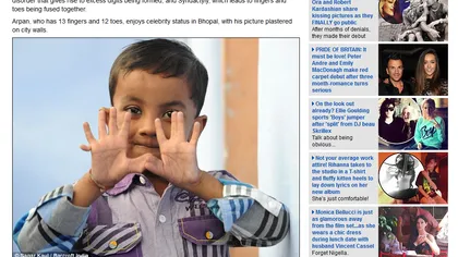 Un băiat din India are 25 de degete FOTO