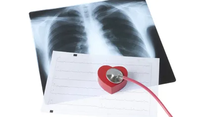 România, în fruntea ţărilor europene în ceea ce priveşte prevalenţa bolilor pulmonare