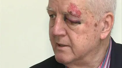 Jean Pădureanu, preşedintele Gloriei Bistriţa, a fost bătut şi tâlhărit în Bucureşti VIDEO