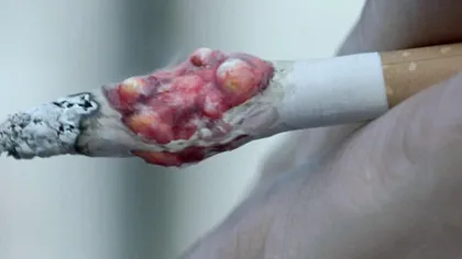 Vrei să renunţi la ţigări? Vezi cea mai SCÂRBOASĂ reclamă împotriva fumatului VIDEO