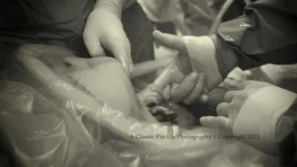 Cea mai emoţionată imagine: Un bebeluş aflat în burtica mamei apucă mâna doctorului
