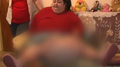 O femeie din Argeş trăieşte cu o tumoră de 50 de kilograme VIDEO