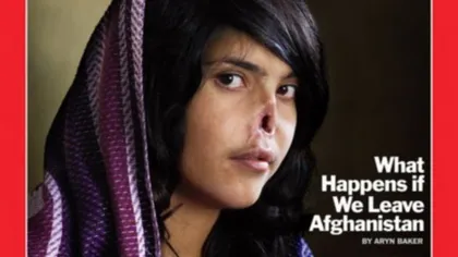 Aesha, fata afgană cu nasul tăiat, şi-a revenit spectaculos. Vezi cum arată! GALERIE FOTO