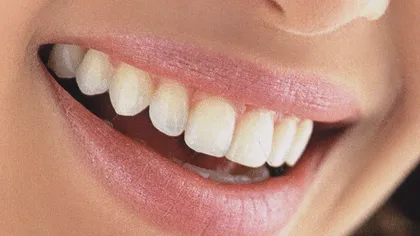 De ce oamenii moderni au dinţii mai bolnavi decât cei din preistorie