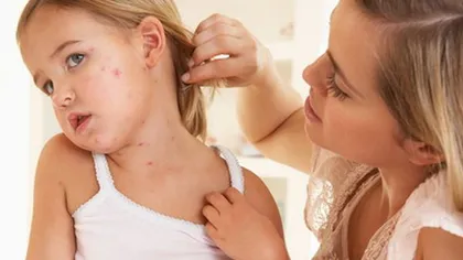 Cele mai comune probleme de piele la copii