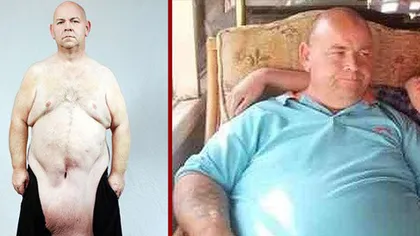 INCREDIBIL: Bărbatul care a slăbit 95 kg şi nu şi-a văzut 12 ani organele genitale