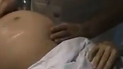 Un ginecolog ÎNTOARCE bebeluşul din BURTA unei gravide, folosindu-se de MÂINI VIDEO