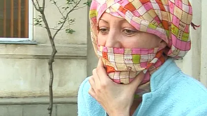 O femeie din Buzău, DESFIGURATĂ la solar. A suferit arsuri pe faţă şi piept