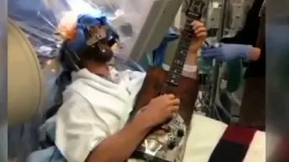 Orice e posibil: Un actor american a cântat la chitară în timp ce medicii îl operau pe creier VIDEO