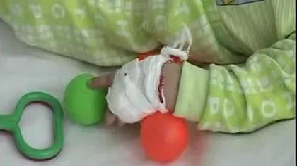 Bebeluş în vârstă de o lună, intoxicat cu nitriţi din apa cu care i-a fost preparat laptele