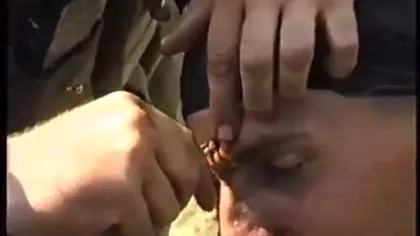 VIDEO INCREDIBIL: Cum este scos un glonţ din FRUNTEA unui SOLDAT, pe front VIDEO