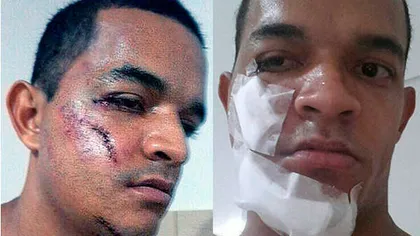 Fotbalul i-a distrus faţa. Accidentare înfiorătoare a unui jucător, în Brazilia VIDEO