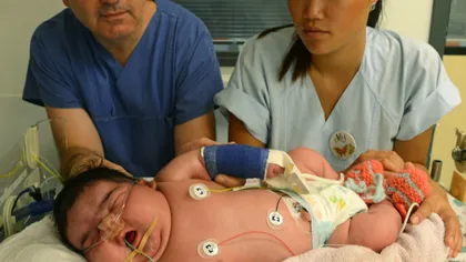 Bebeluş-record în Germania: O fetiţă de 6 kilograme a fost adusă pe lume prin NAŞTERE NORMALĂ