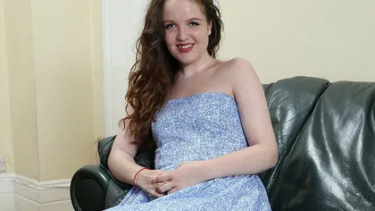 O britanică de 17 ani riscă să devină STATUIE din cauza unei boli genetice ciudate GALERIE FOTO