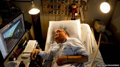 Povestea ULUITOARE a lui Paulo Henrique Machado, brazilianul care trăieşte de 45 de ani în spital