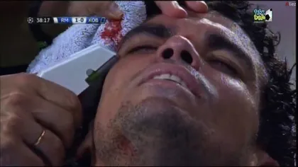 Accidentare înfricoşătoare. Lui Pepe i-a intrat sângele în ochi şi a fost cusut pe viu VIDEO