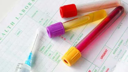 Analiza urinei ar putea înlocui, în viitor, investigaţiile de sânge şi biopsii