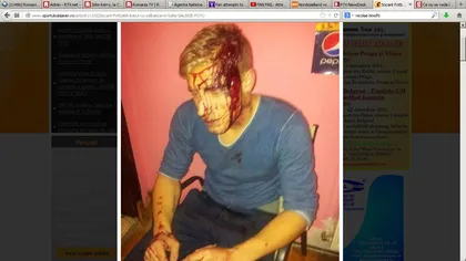 Fotbalist britanic, bătut cu bestialitate şi lovit cu toporul în cap la Sălaj. Romii l-au băgat în spital