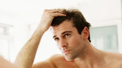 MITURI despre căderea părului la bărbaţi