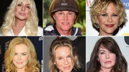 Vânzările Botox cresc, deşi tot mai multe vedete de la Hollywood demonizează produsul-minune