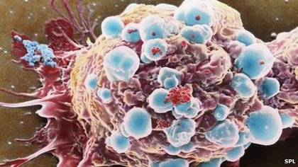 Cercetătorii au descoperit cum ar putea opri răspândirea cancerului: Prin 
