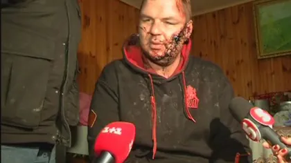 Poveste ŞOCANTĂ: Un protestatar ucrainean a fost răpit, bătut şi chiar crucificat VIDEO
