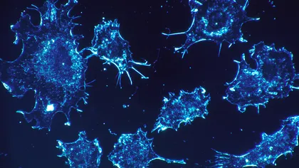 Raport ÎNGRIJORĂTOR al OMS: Cancerul, un flagel care se extinde necruţător în întreaga lume