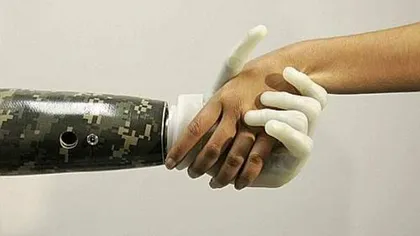 Reuşită medicală: Prima mână bionică care va fi controlată de sistemul nervos