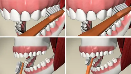 VIDEO: 9 greşeli de igienă dentară: cum să te speli corect pe dinţi