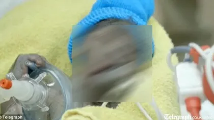 Este adorabil: Un pui de gorilă a venit pe lume printr-o operaţie rară de CEZARIANĂ VIDEO