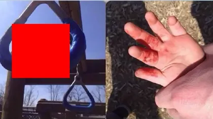 Descoperire şocantă în parc: Un băieţel de doi ani a ajuns la spital din cauza unui gest INEXPLICABIL VIDEO