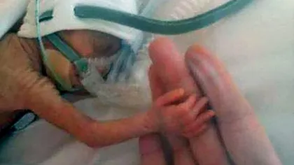 Dorinţa de luptă a unui BEBELUŞ născut cu 4 LUNI înainte de termen: Avea 500 de grame când a venit pe lume