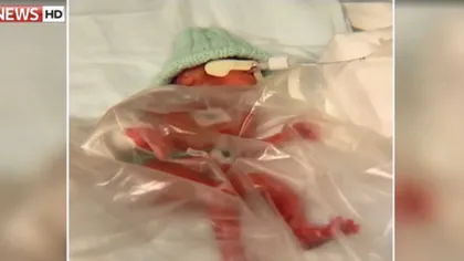 Un bebeluş a uimit medicii: A fost născut prematur şi are doar 400 de grame, dar luptă să trăiască VIDEO