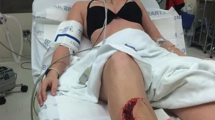 O tânără a scăpat ca prin minune după ce a fost atacată de un RECHIN