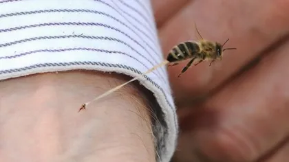 Un bărbat a murit după ce a fost înţepat de o albină