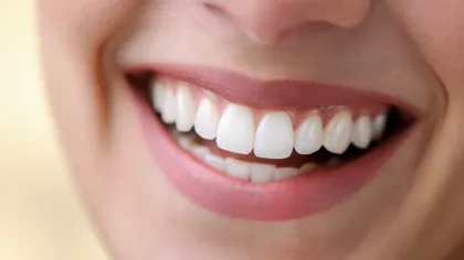 Vrei să ai dinţi sănătoşi şi frumoşi? Tot ce trebuie să ştii despre 
