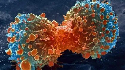Descoperire românească împotriva cancerului. Ce plantă stopează multiplicarea celulelor canceroase